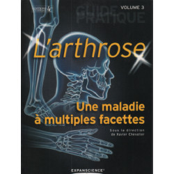 L'arthrose une maladie a plusieurs facettes